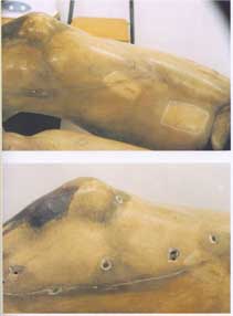 Rodilla